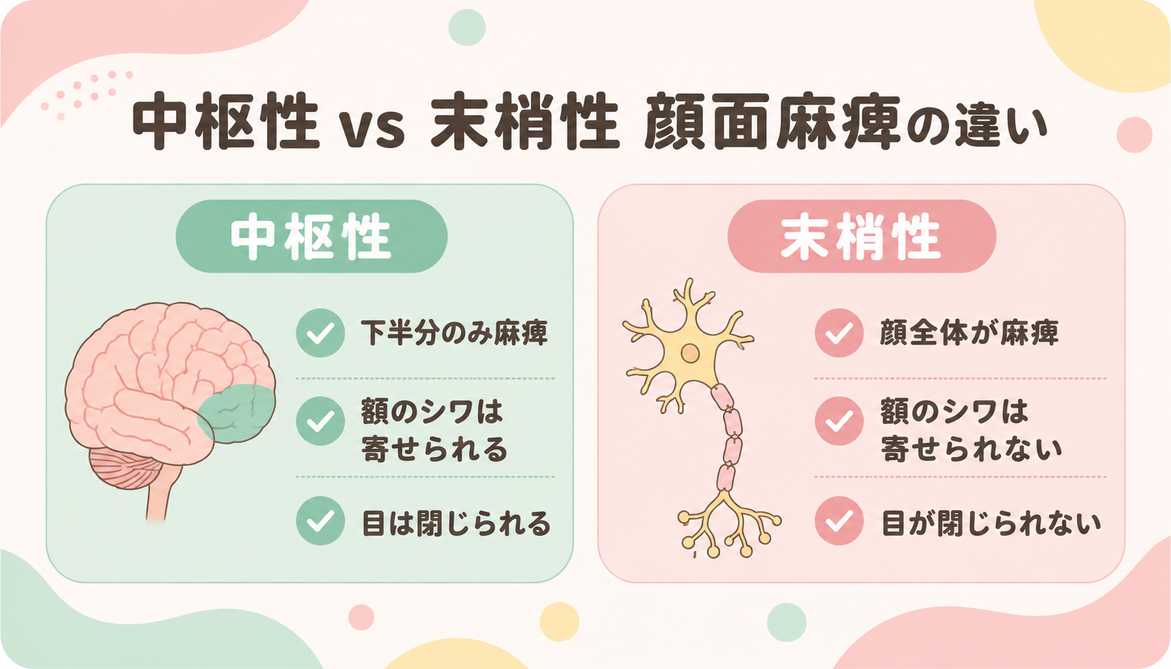中枢性と末梢性の顔面神経麻痺の違い 比較図解