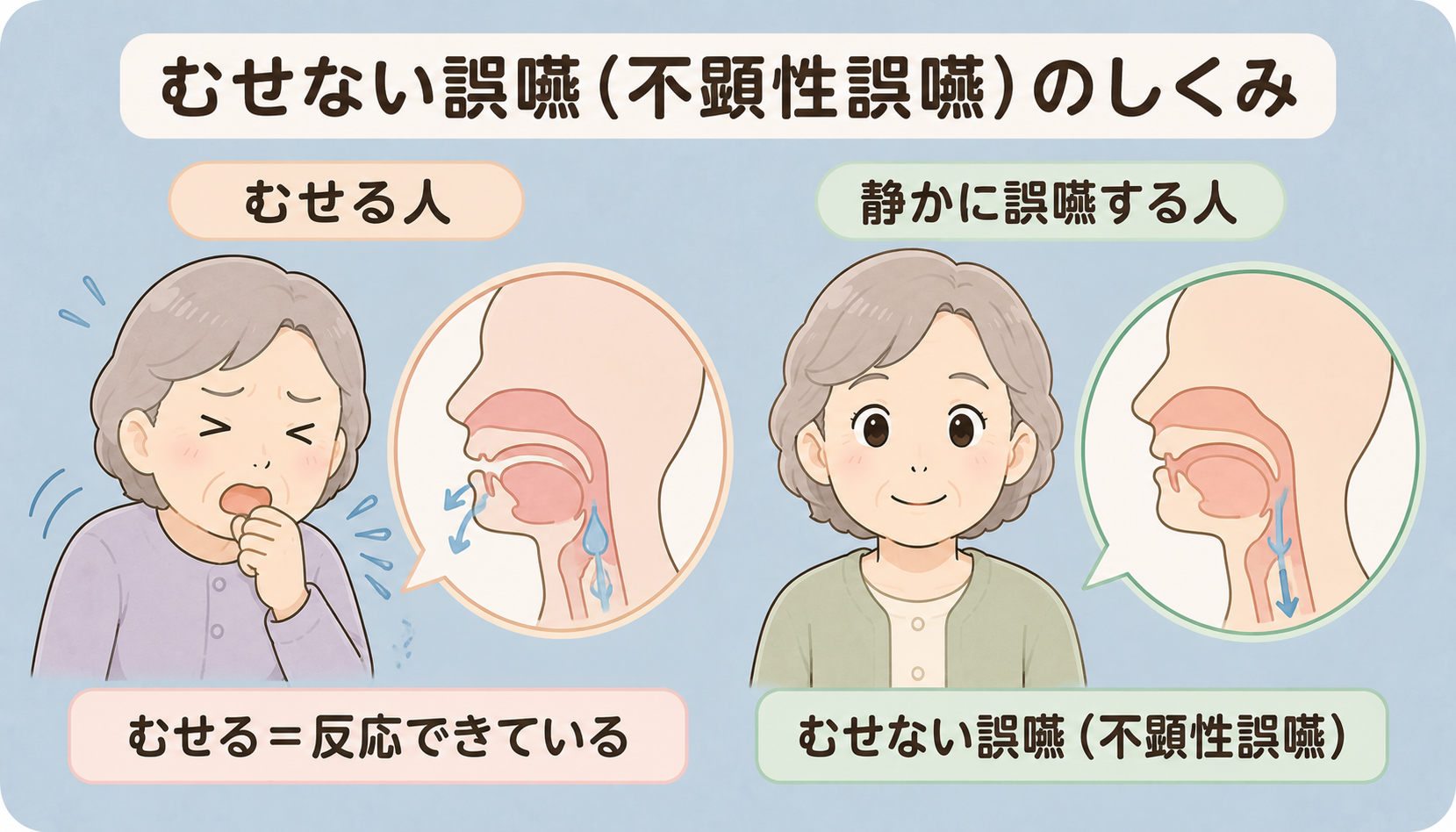 むせている人と、むせずに静かに誤嚥している人を比べた図解